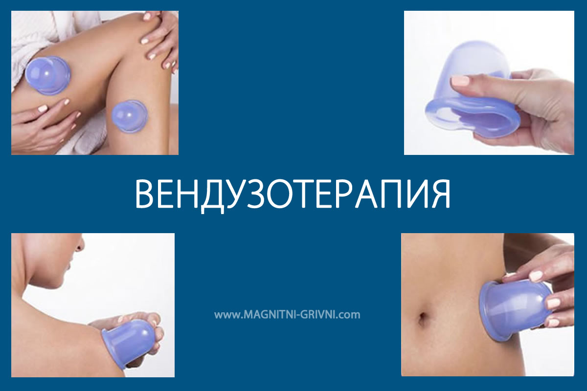 Какво е Вендузотерапия или лечение с вендузи?